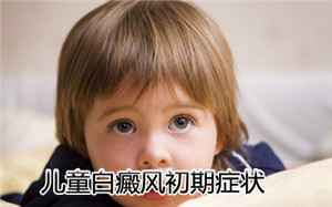 白癜风治疗